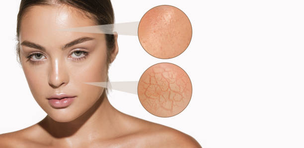 serum con vitamina c piel grasa